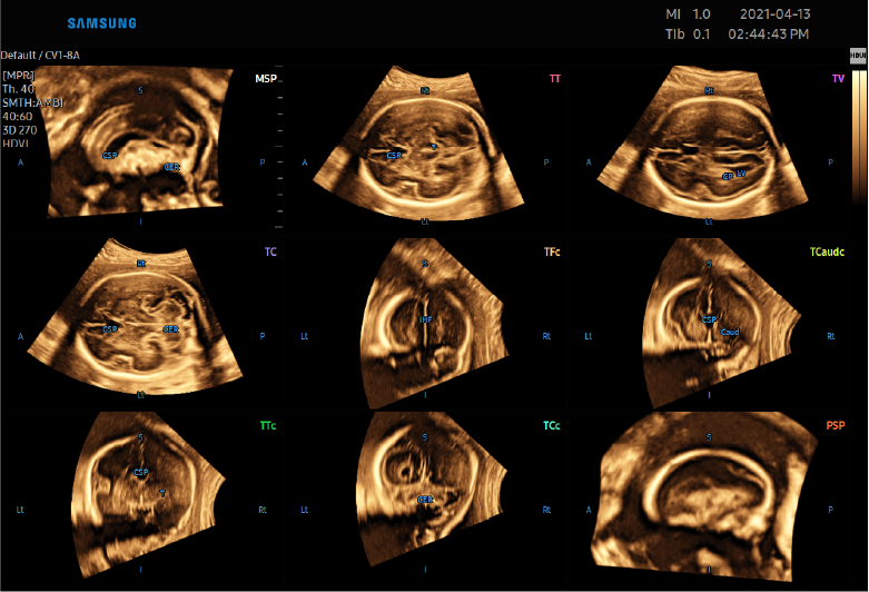 5D CNS+™