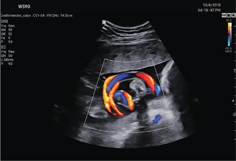 LumiFlow™ para mama
