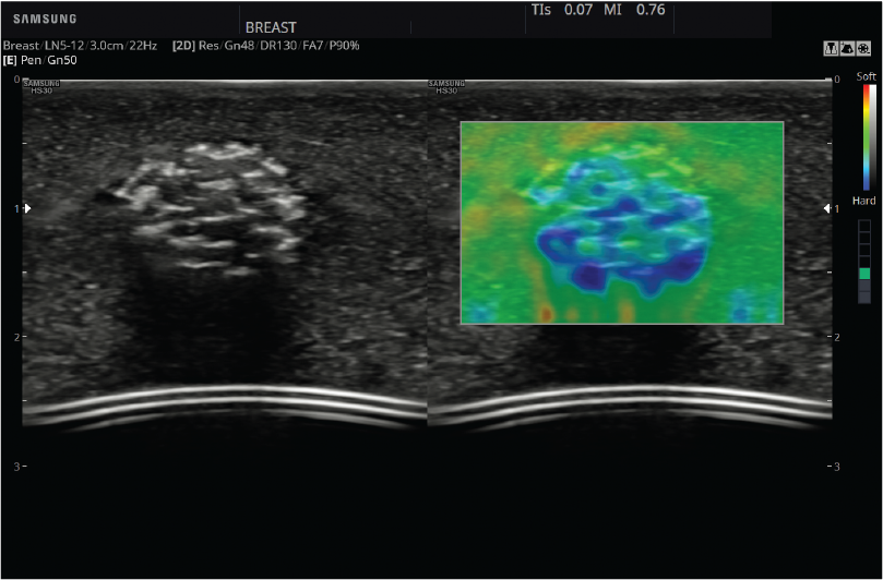 ElastoScan™