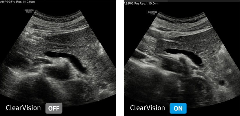 ClearVision
