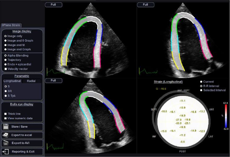 S-3D Arterial Analysis™