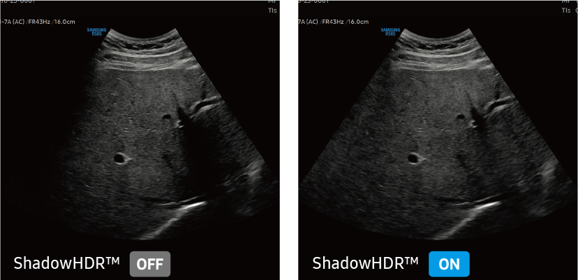 ShadowHDR™