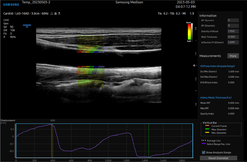 Arterial Analysis™